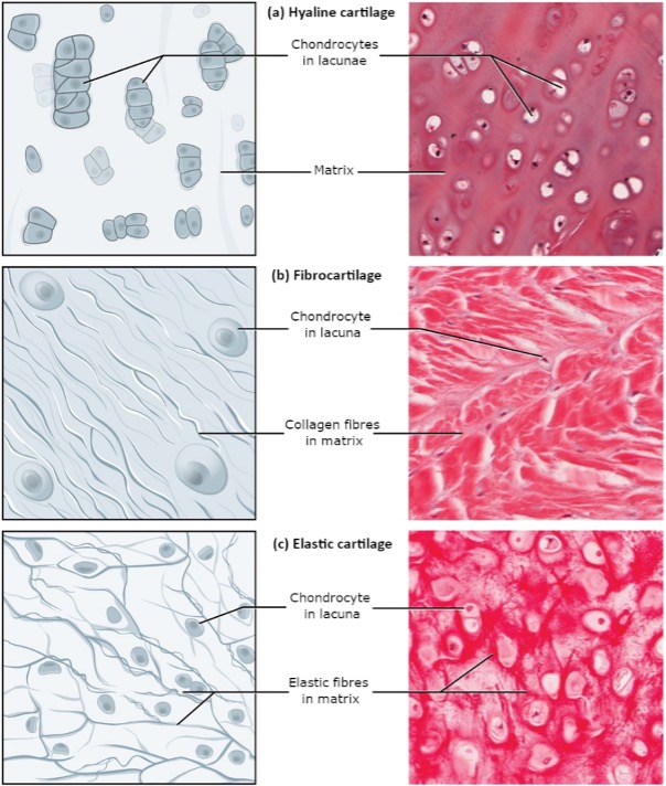 Types of cartilage. Cartilage is a connective tissue consisting of collagenous fibres embedded in a firm matrix of chondroitin sulphates.