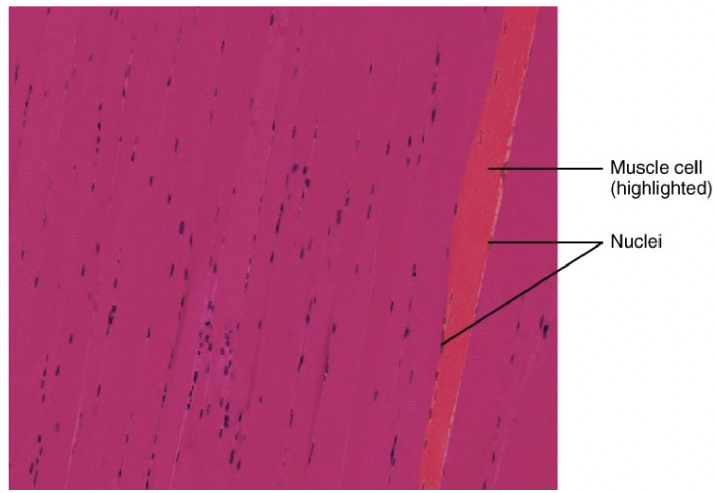 Multinucleated muscle cell.
