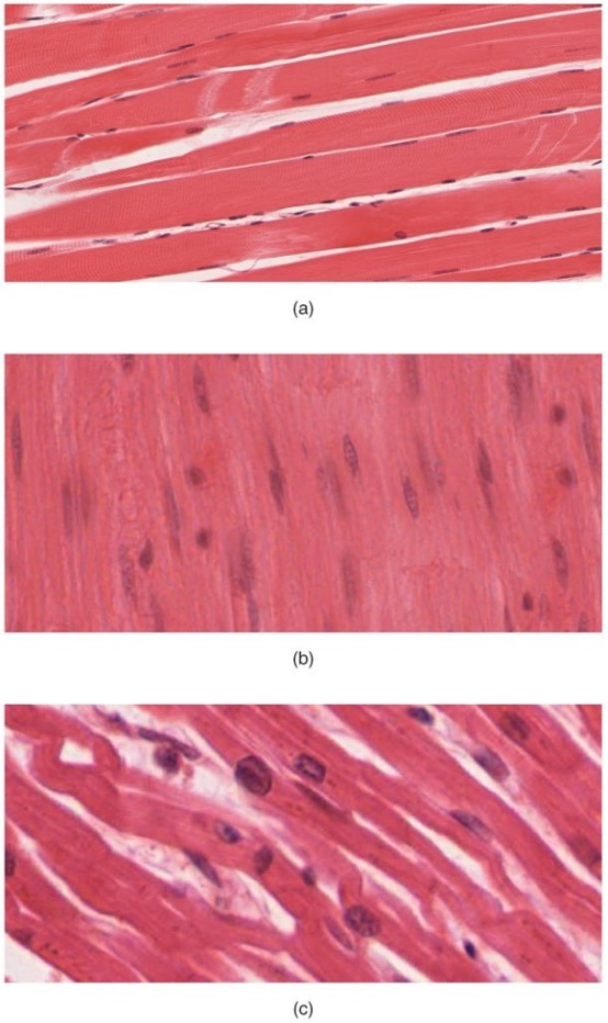 Types of muscle
